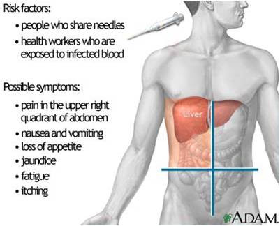 Hepa B - Hepatitis B