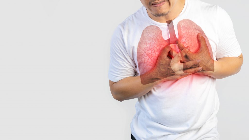 Tuberkulosis dalam Skala Global dan Indonesia - Tuberkulosis dalam Skala Global dan Indonesia