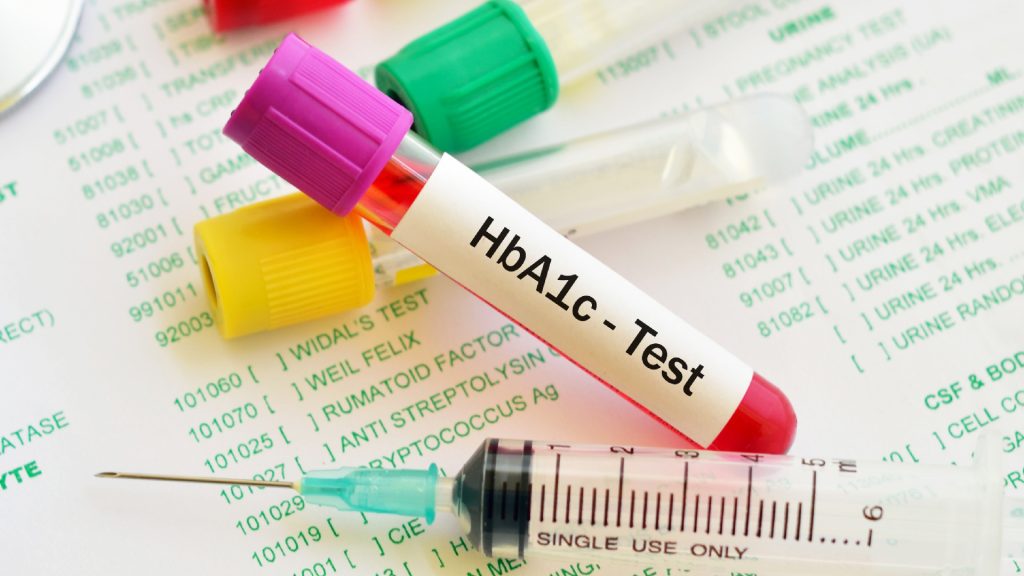 1 3 - Alasan Pentingnya Tes HbA1C Bagi Pekerja
