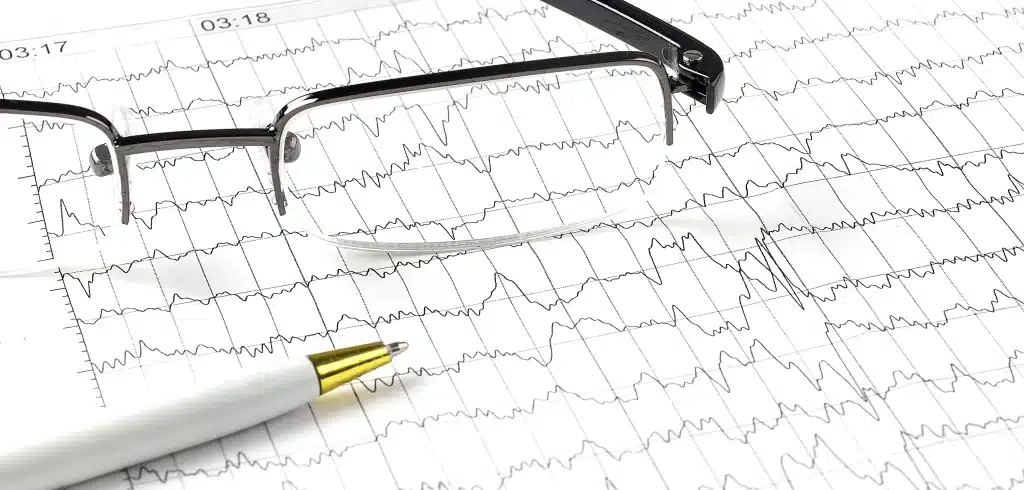 Pemeriksaan EKG dilakukan untuk memantau kesehatan jantung.