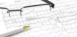 Pemeriksaan EKG dilakukan untuk memantau kesehatan jantung.